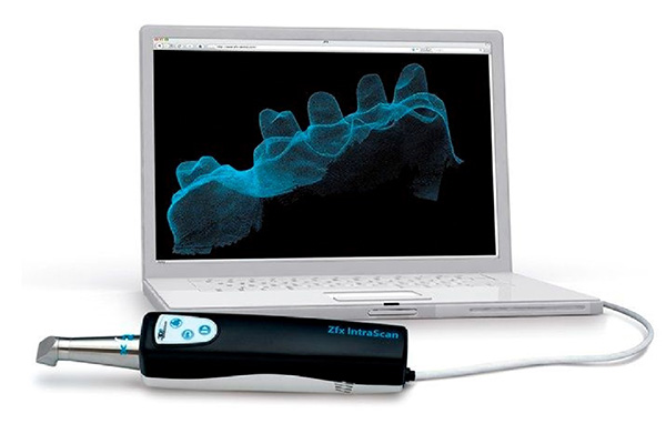 Scanner-digitale-intraorale
