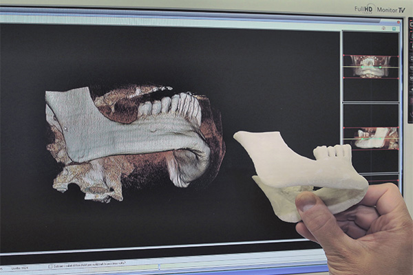 stampa-mascellare-da-progetto